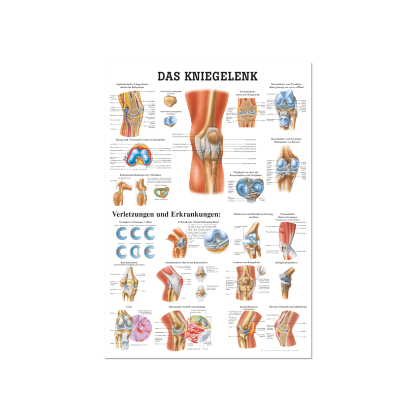 Lerntafel Kniegelenk