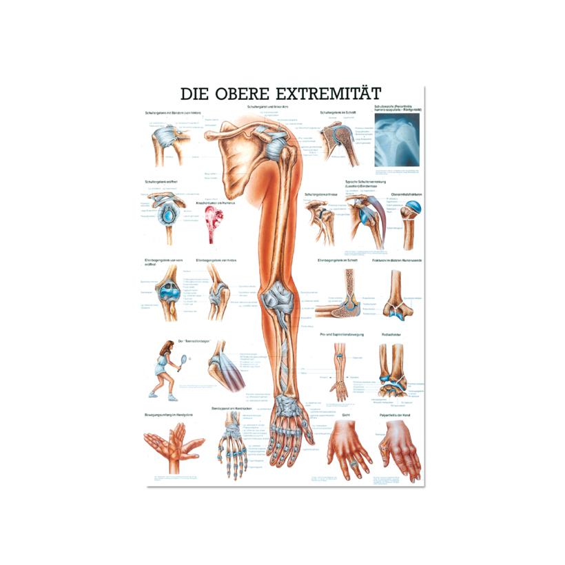 Lerntafel obere Extremität